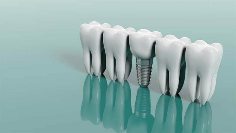 Başarısız implant belirtileri, implant işlemi başarısız olursa