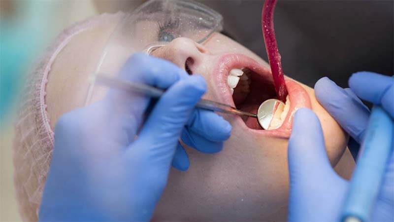 Diş Eti Çekilmesi, Diş Eti Çekilmesi Belirtileri, Diş Etki Çekilmesi Nedenleri, Diş Eti Çekilmesi Tedavisi