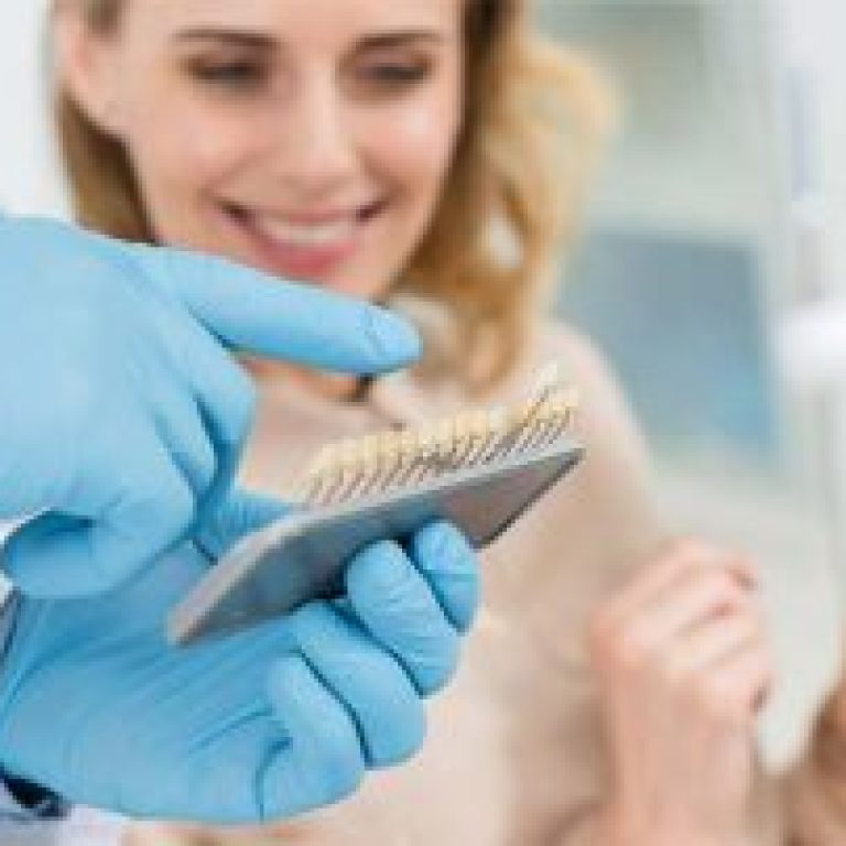 implant-basarisini-etkileyen-faktorler-nelerdir-320x202