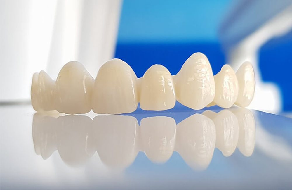 zirkonyum-dis-kaplama