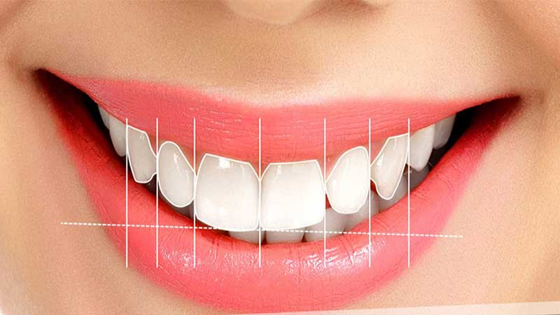 Gülüş Tasarımının Yüz Yapısına Etkileri Nelerdir?