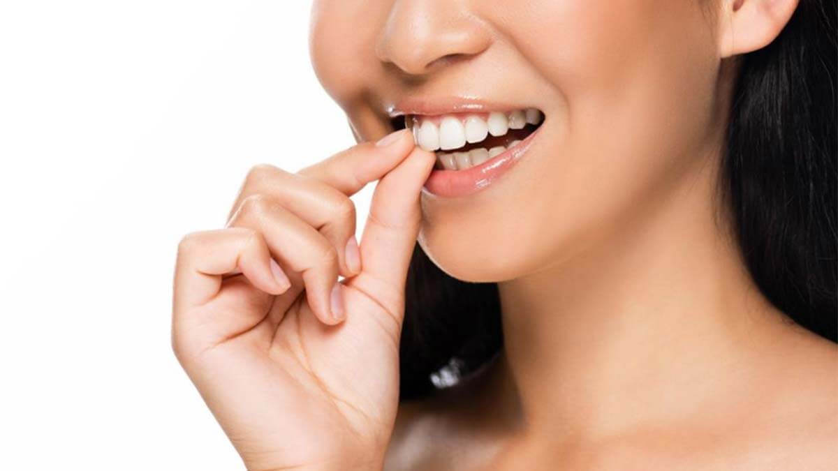 Yeni Nesil Diş Protezi, Çıt çıt yeni nesil diş protezi, Misafir diş protezi